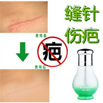 Remove childrens frostbite soften and dilute cesarean section raised pimples remove hypertrophic knife scars after stitches and ink ink