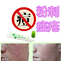 Remove facial mens and womens repair essence acne scars acne rosacea products front chest back and forehead