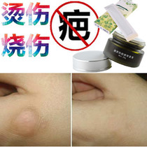 Miracle grass removes hypertrophic pimples caused by tobacco burns fades pigments removes burn bumps smoke scars and removes liquid cream.