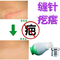 Ling Zengsheng repairs bumpy bumps surgery hypertrophic cuts scars tattoos stitches scratches falls bumps and scars