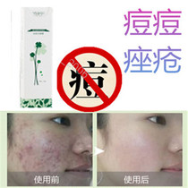 Repair soothe and prevent sensitive pimple marks. Remove forehead blackheads and acne scars. Essence cream removes pimple pigment on back.