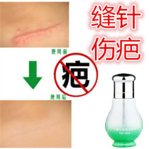 Removal of hyperplasia cigarette burns bumps surgery hyperplasia knife wounds scars tattoos stitches scratches falls pigment marks