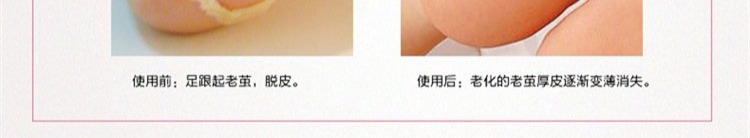 Mùa thu và mùa đông nam và nữ chân cao gót chân silicone chống khô chocks gót chân nứt tất bảo vệ chân vớ bảo vệ tất đùi