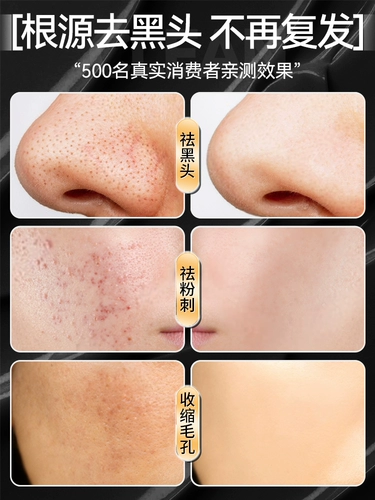 Носовые полоски от черных точек, мужское средство для удаления прыщей, сужает поры, глубокое очищение