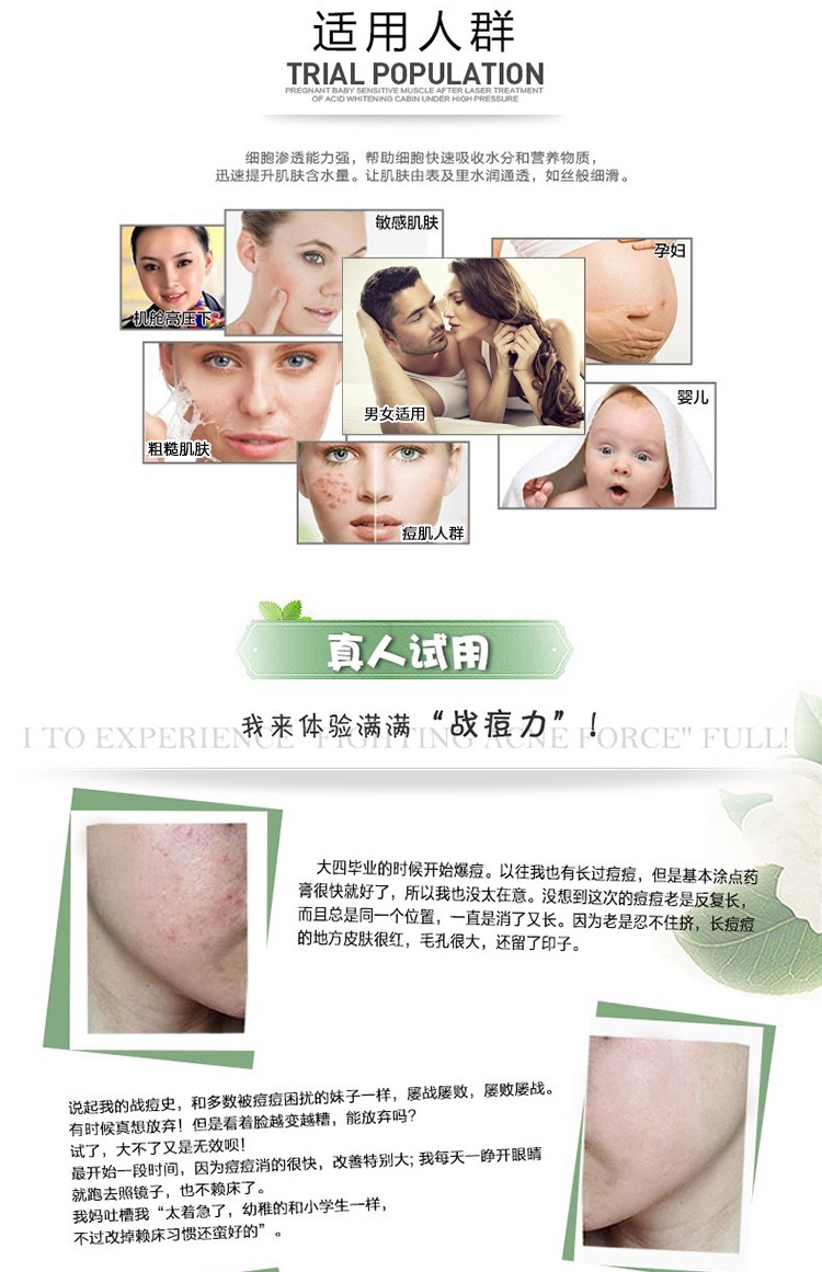 Essence 科娜 essence Tinh chất in trị mụn thu nhỏ lỗ chân lông mịn màng để sửa chữa làm săn chắc da mặt cho nam tinh chất bơ skinaz