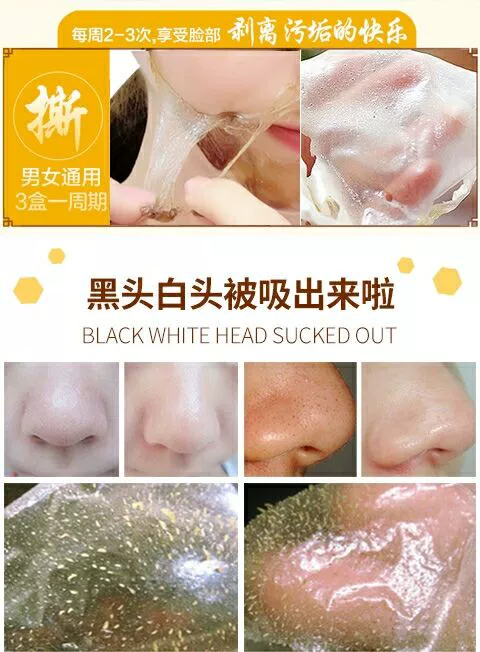 Yêu làn da nên dưỡng ẩm sâu làm đẹp da mặt 120g dưỡng ẩm trắng loại bỏ da chết mặt nạ sừng đen. - Mặt nạ