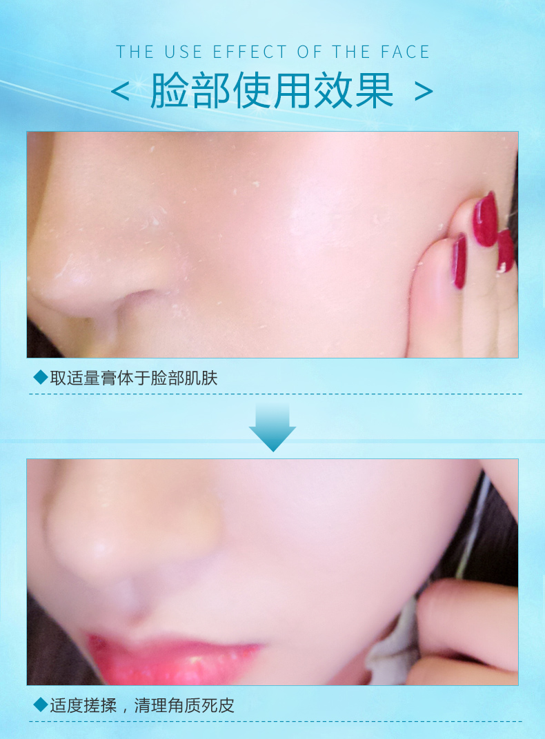 Tẩy tế bào chết da chết mặt lỗ chân lông làm mềm lớp 祛 mặt gel gel chà để làm trắng mặt nạ kem tẩy da chết mặt