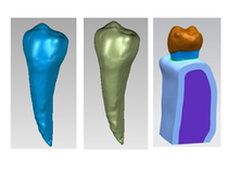 Finite element analysis of dental and other biomechanical medicine