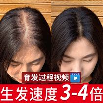 Anti-hair loss shampoo Ginger anti-dandruff anti-itching oil control shampoo Hair growth Hair fluffy polygonum polygonum for men and women