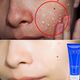 Tẩy tế bào chết mặt nam nữ tẩy tế bào chết mụn đầu đen gel làm sạch sâu mặt toàn thân giữ ẩm gà chà da tẩy tế bào chết hóa học Massage mặt / tẩy tế bào chết