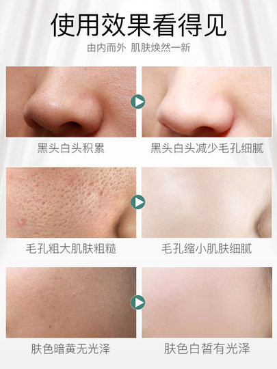 Deep Cleansing Facial Pore Dirt Blockage Deep Cleansing Skin Clearing Cream Massage Cream Detoxifying Facial Authentic Product