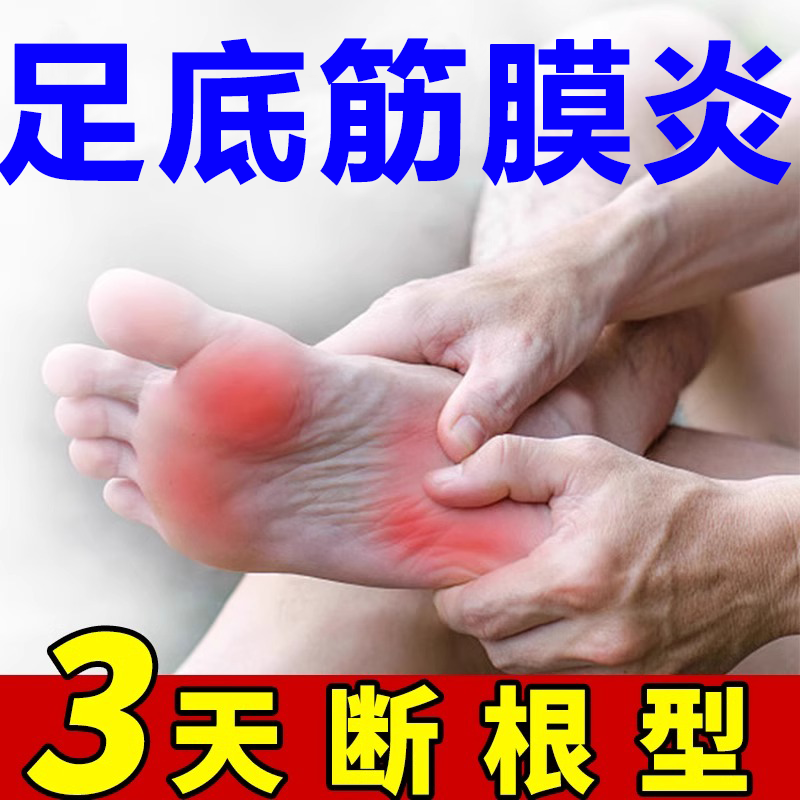 Foot Heel Pain Special Medicine Cream Plantar Fasciitis Special Medicine Treatment Foot Heel Pain Swelling Activity Limited Spray TG-Taobao