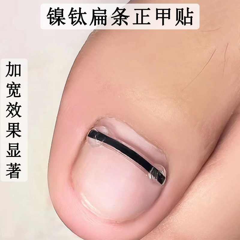 Nickel-Titanium Widened Flat Strip Nail Correction Tool, Flat Steel Wire Silicone Patch for Correcting Ingrown Toenails, Special Tool for Treating Toenail Pain and Nail Groove Inflammation Nickel-Titanium Widened Flat Strip Nail Correction Tool, Flat Steel Wire Silicone Patch for Correcting Ingrown Toenails, Special Tool for Treating Toenail Pain and Nail Groove Inflammation