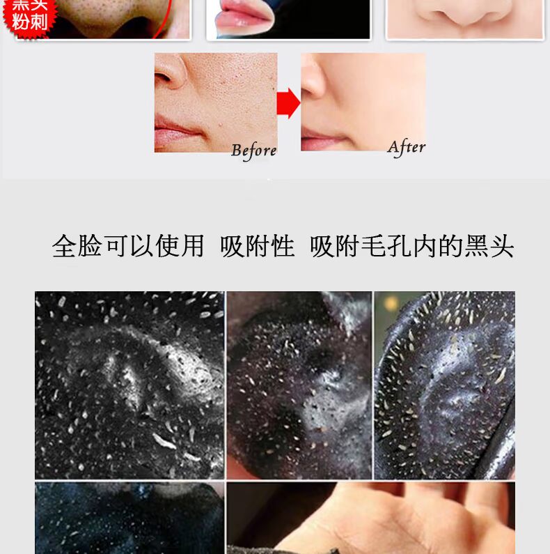 Mụn đầu đen xé rách màng mũi sạch sẽ thu nhỏ lỗ chân lông cho nam và nữ mặt nạ trị mụn đầu đen mặt nạ dưỡng trắng