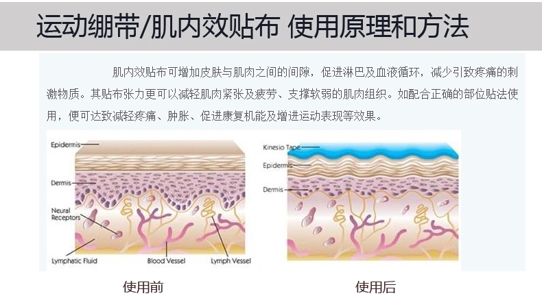 Protection sport - Ref 586235 Image 9