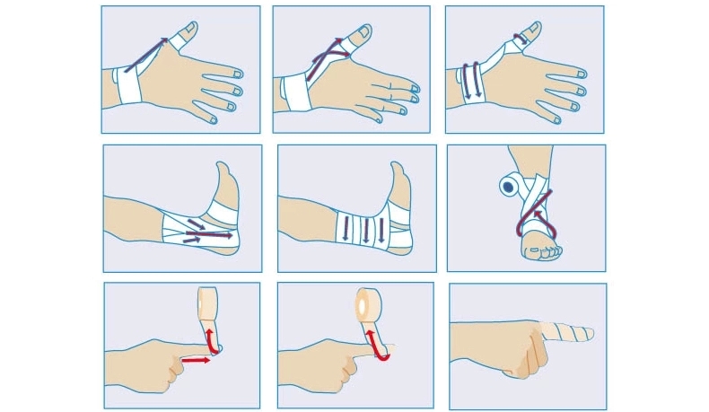 Protection sport - Ref 586235 Image 10