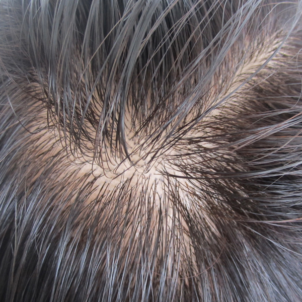 Extension cheveux - Ref 223951 Image 10