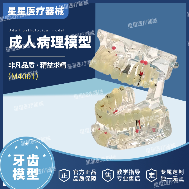 牙科综合病理演示模型仿真牙模医患病理演示模拟口腔牙科教学模型