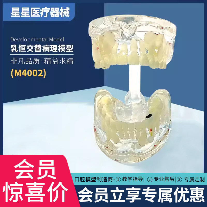 牙科口腔乳牙交替病理模型口医患沟通修复体综合模型可拆卸牙模