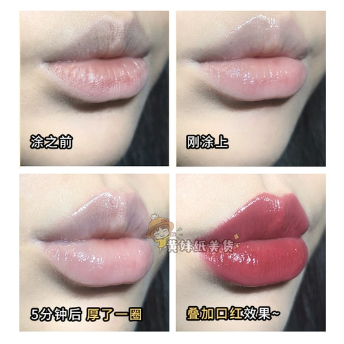 Рекомендуется слишком обработанная гиалуроновая кислота.