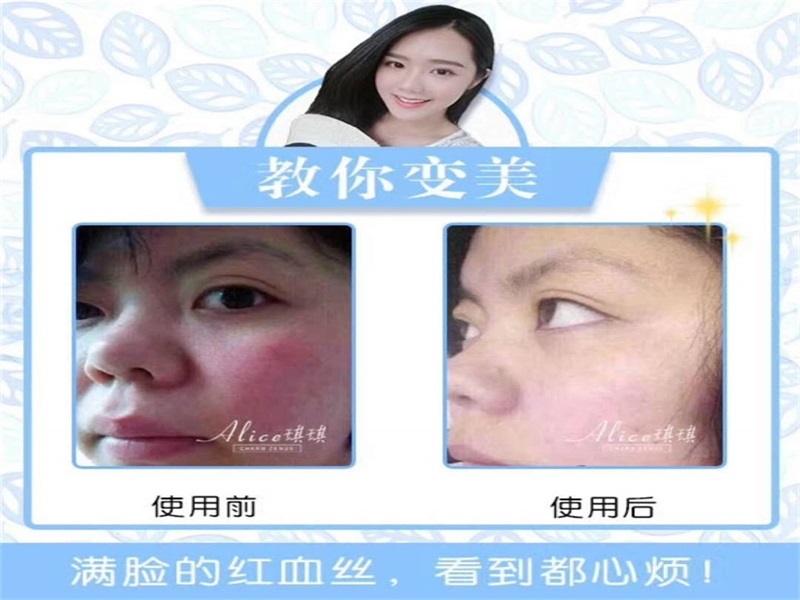 Trang điểm sứ cơ bắp protein cơ bắp hoàn hảo trứng cơ trang điểm bộ cơ sở người mới bắt đầu trang điểm mỹ phẩm che khuyết điểm - Bộ trang điểm son cho mẹ bầu