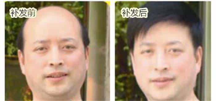 Extension mèches - Ref 216764 Image 11