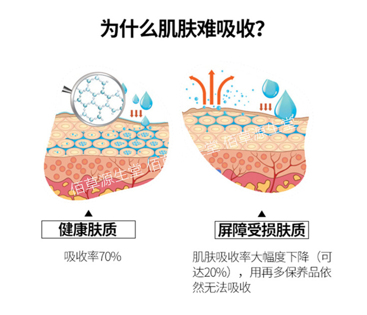 Sửa chữa sừng kim cương vàng nguyên chất lỏng mặt đỏ máu lụa sửa chữa nội tiết tố da mặt sáng mụn mụn một serum tri mun