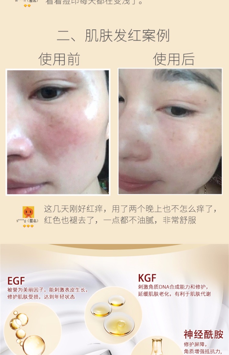 Tinh chất dưỡng da mặt đỏ ngứa Sửa chữa giữ ẩm Máu lụa đỏ tinh chất estee lauder