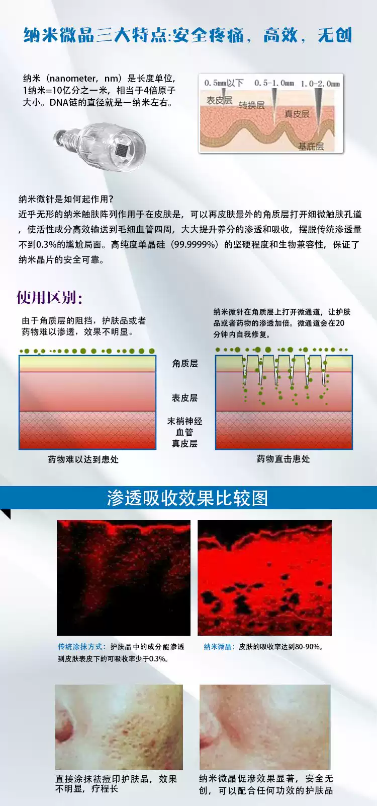 正品纳晶纳米晶片3DL一GZD针中胚层冻干粉导水光针电动微针针头