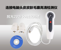 Beauty Salon Skin High-definition Detector Computer Scalp Hair Follicle Hair Enlargement High-definition Detection Portable Detector