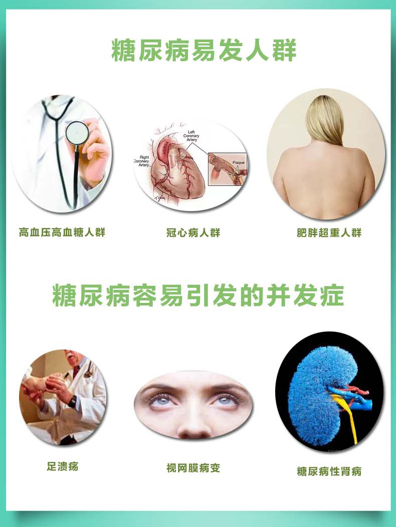 2 chai Mỹ nhập khẩu OPD nguyên tố crôm tự nhiên hóa trị ba crôm 500mcg90 viên hạ đường huyết sản phẩm cao cho sức khỏe - Thức ăn bổ sung dinh dưỡng viên uống bổ sung
