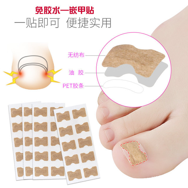 Korean Toenail Correction Glue-Free Patch, Micro-Force Correction for Ingrown Toenails, C-Shaped Nail Pedicure Shop Toenail Patch, Suitable for Personal Use