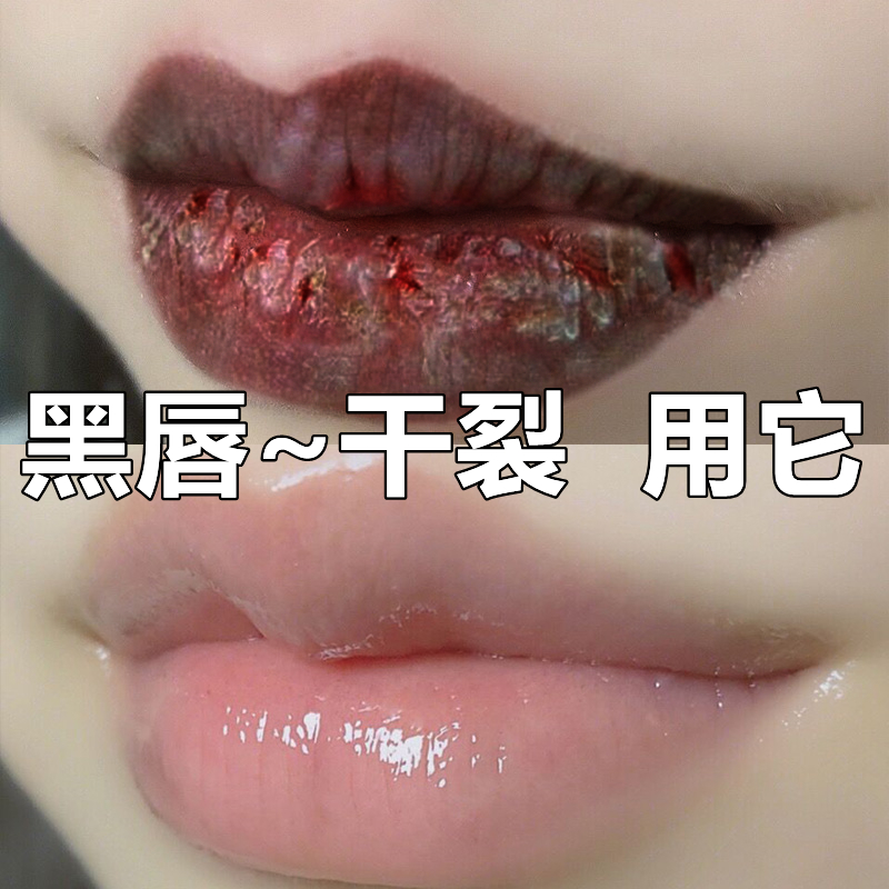 (Recommended by good things) Black lips remove dry skin, essence care fades black corners of the mouth, improves dullness and prevents chapping