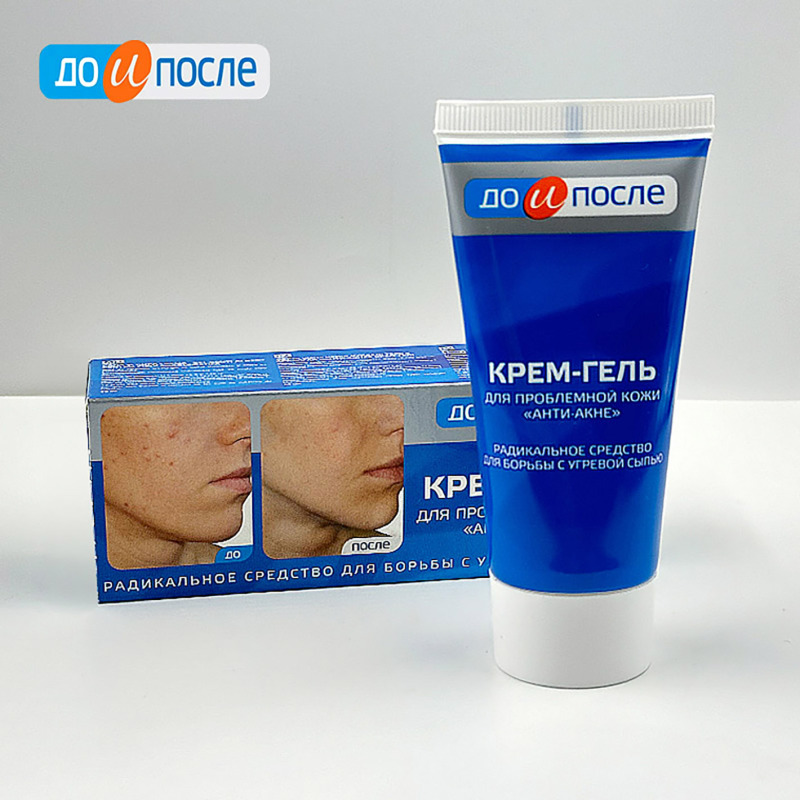 Original Imported from Russia, Anti-Acne and Repairing Cream for Front and Back, Removes Oil, Treats Acne-Prone Skin, Pimples, and Provides Moisturizing and Hydrating Effects