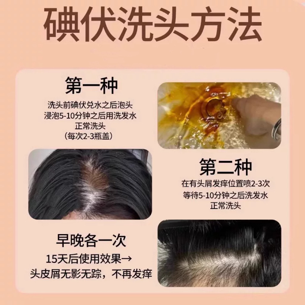 碘伏洗发水真的能治毛囊炎?油头止痒保姆级用法大揭秘_头发护理_淘宝美妆网