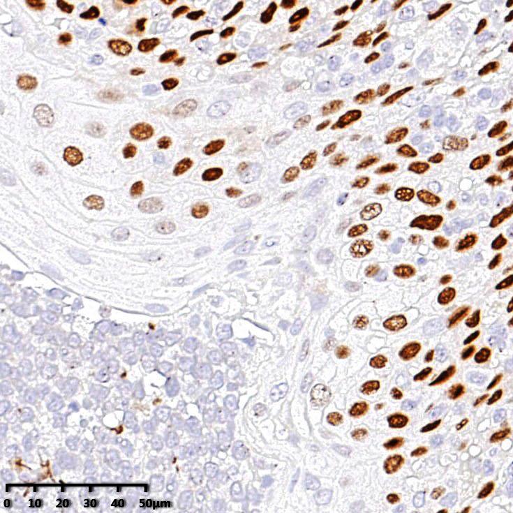 中杉金桥 ZA-0483 p40抗体试剂（免疫组织化学）