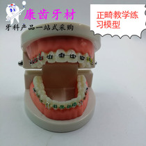 Dental Oral orthodontics with togroove false tooth model Medical patient communication teaching model orthodontic practice model