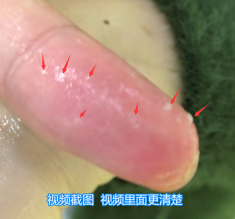 Hàn quốc Yue Shi phong cách rượu vang đỏ tẩy tế bào chết chà để da chết kem cơ thể toàn thân mặt khuôn mặt nữ sừng tẩy tế bào chết body quế hồi