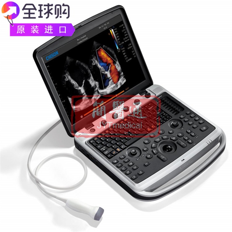 Chison SonoBook 8高分辨率先进图像处理数字彩色多普勒超声仪