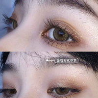 14.2mm