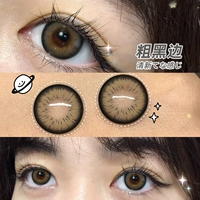 14.5mm