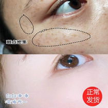 Herbal freckle cream freckle whitening light spot freckles chloasma official website genetic spot age spot stain artifact