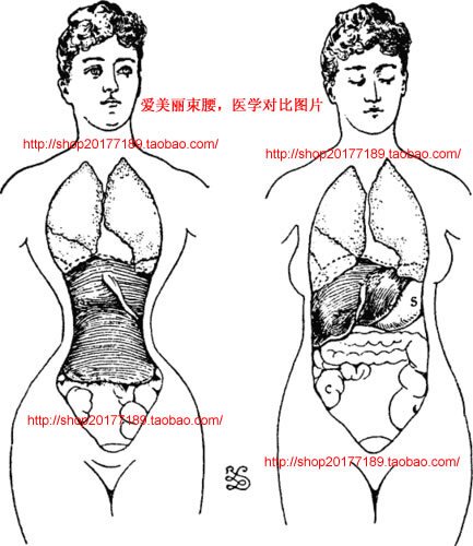 Corset - Ref 683487 Image 17