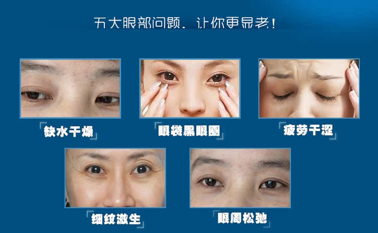 Mật khẩu nước kem mắt đến quầng thâm túi mắt dưỡng ẩm tinh chất chăm sóc mắt tinh chất nữ cửa hàng chính hãng kem trị quầng thâm mắt