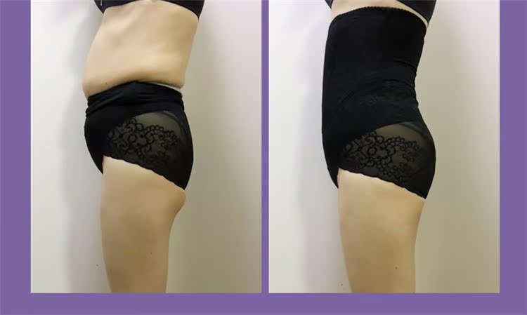 Quần lót bụng phụ nữ eo cao sau sinh bụng nhỏ bụng định hình chùm corset lấy lại cơ thể định hình quần cơ hông đồ lót ibasic