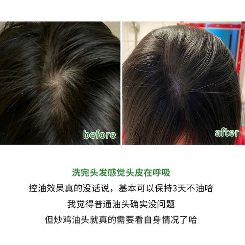 Шампунь, крем подходит для вьющихся волос, кондиционер, контроль жирного блеска, придает объем, удаление перхоти, против зуда