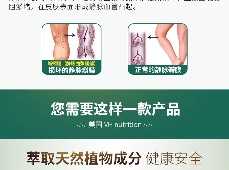 Mỹ VH giãn tĩnh mạch sản phẩm cải thiện chi dưới tinh trùng đau lưu thông máu ít vận động đứng lâu 60 viên - Thức ăn bổ sung dinh dưỡng thực phẩm chức năng giúp ngủ ngon