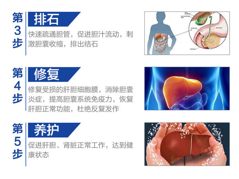 Viên nang ngọc trai lysine của Mỹ viên nang gan sỏi đá sỏi sản phẩm chăm sóc sức khỏe làm giảm đau sỏi mật - Thức ăn bổ sung dinh dưỡng tảo xoắn spirulina