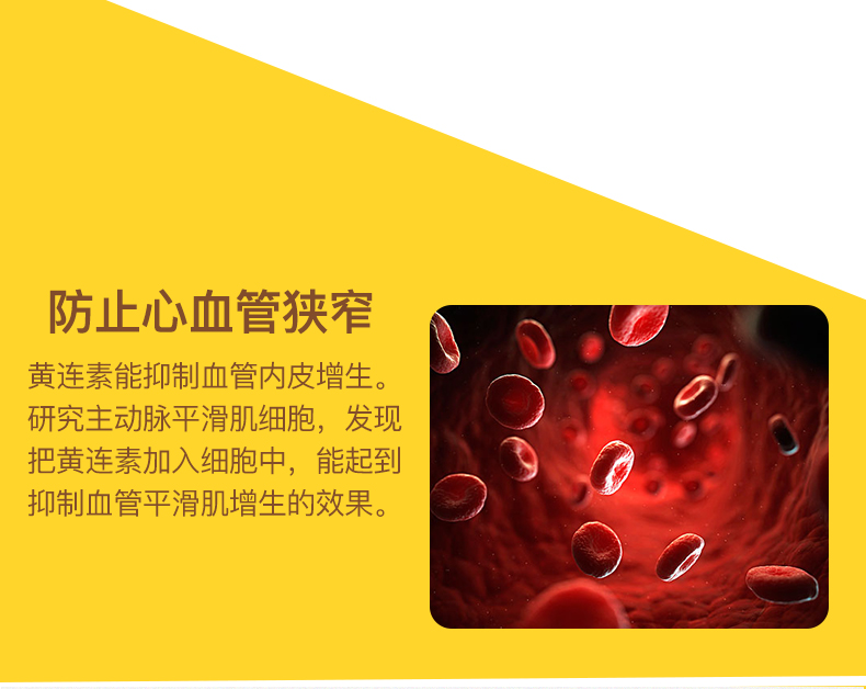 Hoa Kỳ Sunberetic berberine viên nang nhiễm trùng đường ruột chăm sóc tim và huyết áp sản phẩm sức khỏe hạ đường huyết - Thức ăn bổ sung dinh dưỡng viên vitamin a