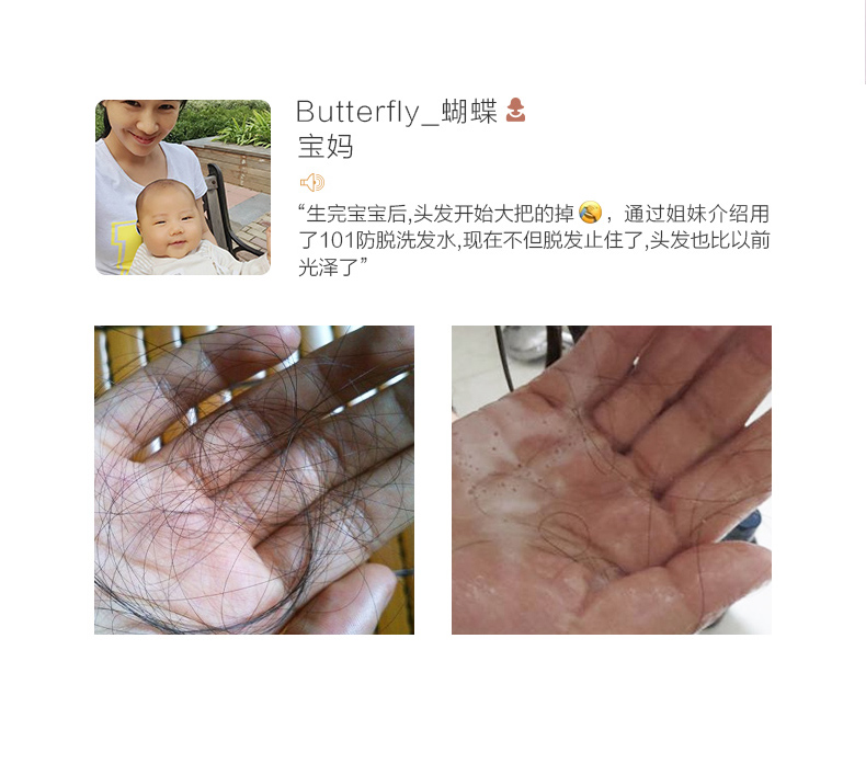 章光101瑞丝育发防脱发洗发水防掉发断发控油浓密增发密发男女